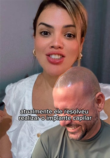 Micro Capilar e Implante Capilar: Dúvidas Esclarecidas