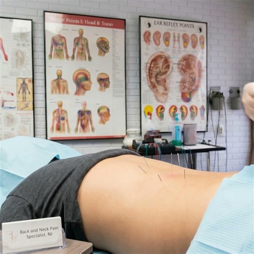Benefits of Acupuncture East Brunswick NJ 08816.