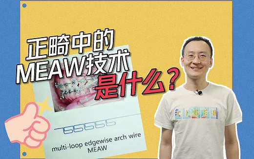 正畸中的MEAW技术是什么