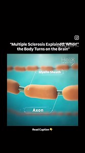 Multiple Sclerosis Animation | Medical Talks