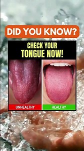 What Your Tongue Says About Your Health 👅⚠️