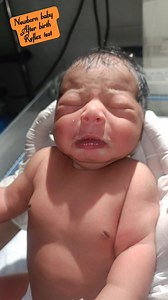 47K views · 1.4K reactions | Newborn baby after birth being Reflex test #motivational #videoviralシ #facebookviral #fbreelsfypシ゚viralvideo #fbreelsfypシ゚viralシ #fbyシreelsviral #fbyシvideo #fbreelsfypシ゚ #fbreels #fbreelsvideo #viralshorts #fbreels2025ツ | Md Shakeel | Facebook