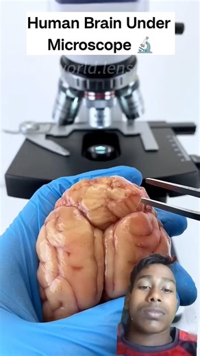 Human brain under the microscope #shorts #youtubeshorts #short #facts #microscope amazing