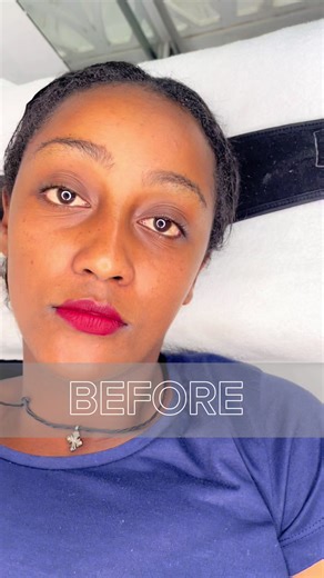 Ethiopian Facial Treatments for Flawless Skin
