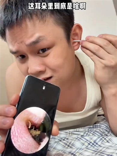Cleaning Ear with Visual Ear Spoon Technique
