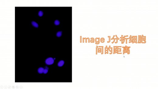 Image J分析细胞间的距离及囊泡与细胞核间的距离