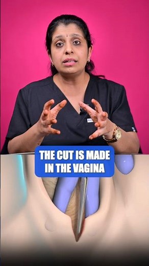 Episiotomy during baby delivery #shorts #normaldelivery #pregnancy