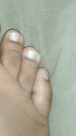 Exploring the Unique Characteristics of Human Toes