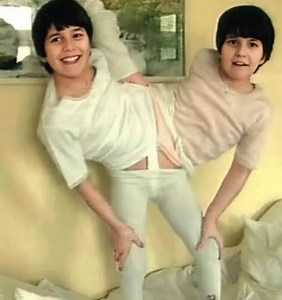 5.2K views | These Siamese twin sisters were born joined at the pelvis  They shared a common intestine, reproductive organs and three legs  When they were 11 years old, doctors de… See more | Creative Arts | Facebook