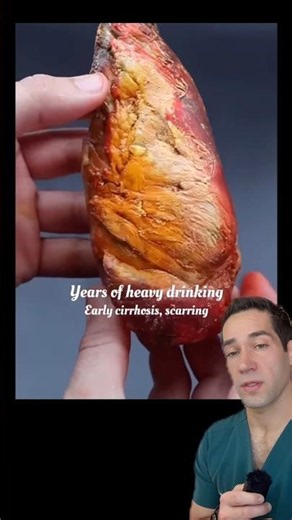 Why drinking is TERRIBLE for your liver!