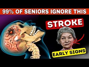 9 Warning Signs of Mini Stroke Weeks Before Major Stroke