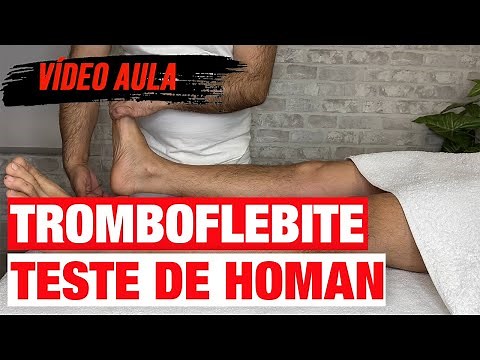 Teste de Homans - Trombose Venosa Profunda - Video Aula