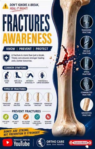 Fracture Awareness: Symptoms, Types & Prevention Guide