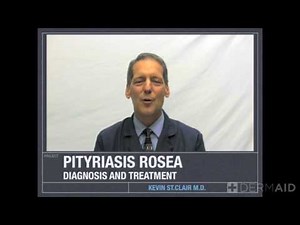 Pityriasis Rosea