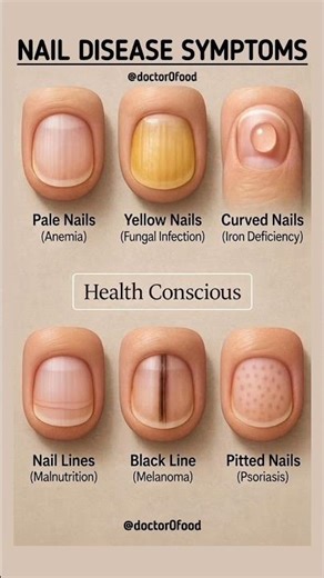 What Your Nails Say About Your Health | Hidden Deficiencies Explained #healthylifestyle #healthydiet