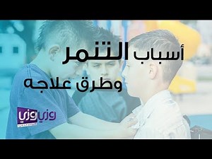 أسباب التنمر وطرق علاجه