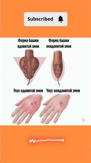 Это самое важное, немедленно обращайтесь к врачам.#здороветіло #массаж