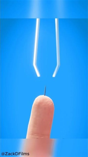 How Your Body Removes Splinters on Its Own 😳