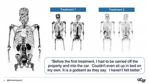 VIDEO: Lu-PSMA Radioligand Therapy - Prostate Cancer Patient Conference 2022