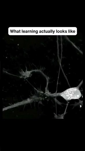 What learning looks like in the brain