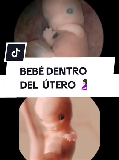 Bebé de 9 Semanas en el Útero: Embarazo Semana a Semana