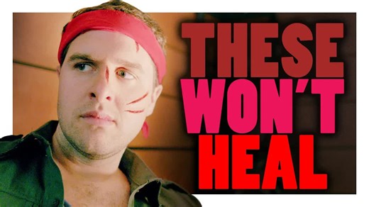 He thinks his scars make him look like a movie villain, but the truth is much more embarrassing | CollegeHumor