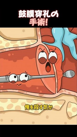 鼓膜穿孔の手術