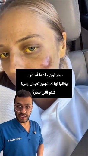صار لون جلدها أصفر... وقالوا لها 3 شهور تعيش بس! شنو اللي صار؟