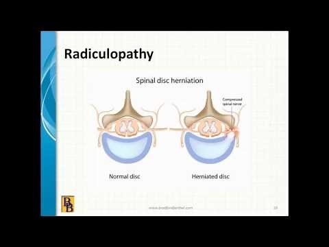 Bradford & Barthel - AMA Guides, 5th Edition, Chapter 15: The Spine