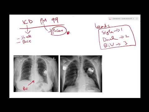 Pacemaker or ICD 99 for medical students and residents - Dr Jamal usmle - cardiology lecture