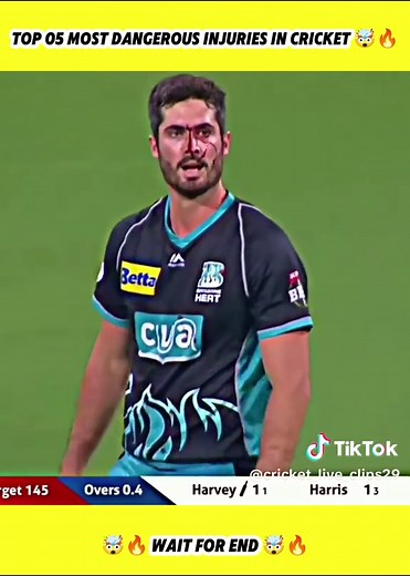 Top 5 Most Dangerous Injuries in Cricket