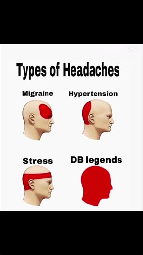 🫩 damn #dblegends #dblegendspvpranked #db | dbl gameplay
