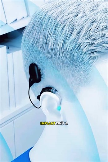 How Cochlear Implant Works? (3D Animation) #cochlearimplant #cochlearimplants #hearingloss #hearinglossprevention #hearinglossawareness #hearingaids #cochlearimplantsurgery #medical3danimation #3dmedicalanimation