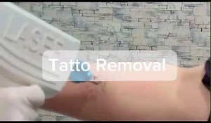 Bodevolution Clinics on Reels