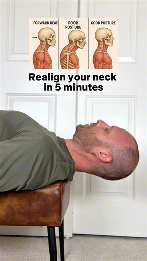 29K views · 315 reactions | If you’ve got forward head posture from...