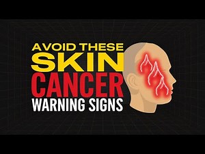Signs of Skin Cancer You Need to Know