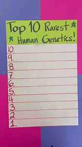 Top 10 rarest human genetics This original video was produced by Network Media LLC Productions, Rick Lax and Jennie Carroll | The Puzzle Couple | Facebook