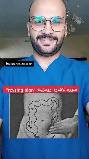 صورة لإشارة روفزينغ "rovsing sign" #الزائدة_الدودية #foryou #foryoupage #fyp #صحتك_الك #Ahmad_Nasser #medical #viral #معلومة_مهمة_وصغنونة #fypシ#أعراض | Ahmad Nasser