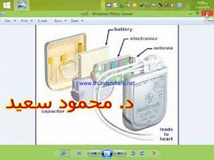 Cardiac pacemakers , ICD &