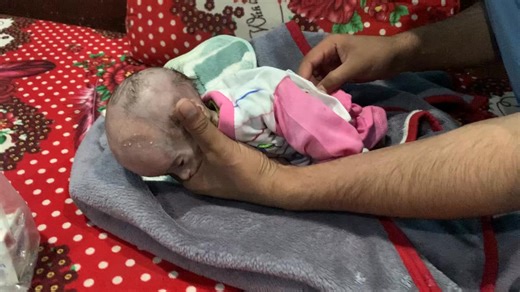 Baby Naveed 👶 Home Visit & Assessment 🏡 | Nurse Checkup & Care Routine 💉 #BabyCare #viral #cute #baby | Anoop Gautam