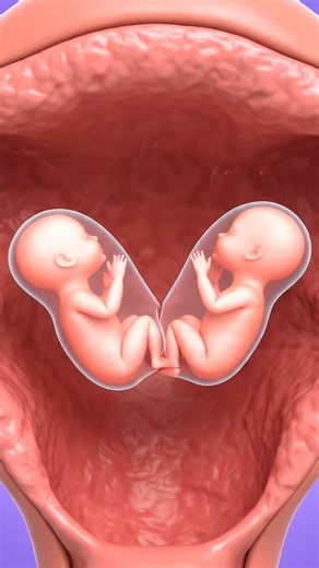 Fraternal Twins Formation #healthfacts