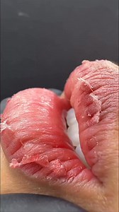 7M views · 10K reactions | Lips safety tips  #lipssafety #lipstips #healthylifestyle #healthtips | Tasty Bestie | Facebook