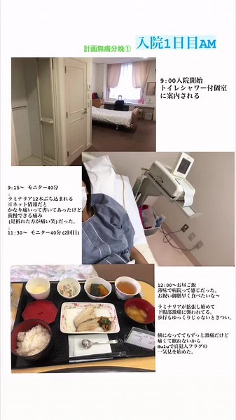 ラミナリアやっぱり痛い。入れる時も痛いけど、入れたあとずーっと痛い。明日は促進剤使って出産です！ #計画無痛分娩 #初マタ #妊婦生活 #予定日12月 #促進剤 #ラミナリア