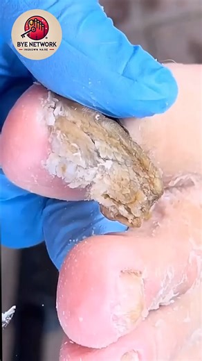 Trusted advice to improve toenail health and boost hygiene naturally 🍅🌹 #SeniorHealth #FootCareTips #HealthyNails | Bye