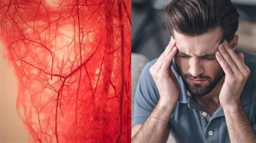 ¿Qué es la vasculitis, cómo se desarrolla y cuáles son sus síntomas?