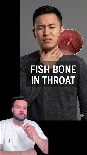 Fish Bone Stuck in Throat? What to Do & What NOT to Do | Quick First Aid Guide