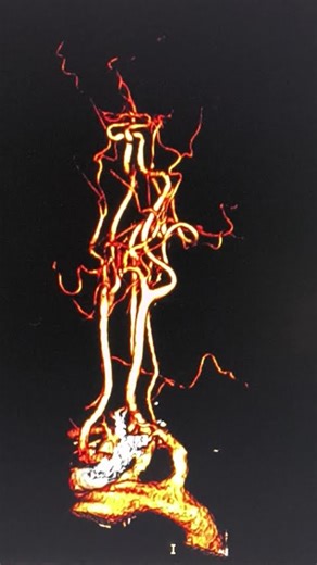 CECT BRAIN AND NECK. #CECT. #MRI. #CT