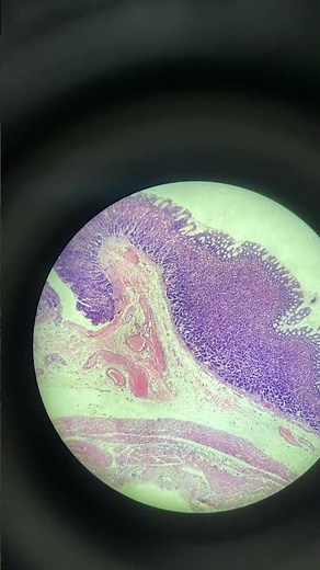 Human Stomach under the microscope LPO and HPO view #histology #medtech #laboratory