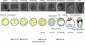 In Vitro Fertilisation (IVF) - Saint Mary's Hospital