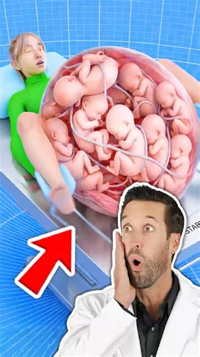 ER Doctor REACTS to Giving Birth on a Spinning Table (Zack D. Films Parody Zeck Felms)